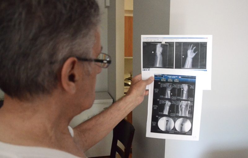 Luc Delisle tenant les radiographies du poignet de sa conjointe. Photo : Denis Bélanger